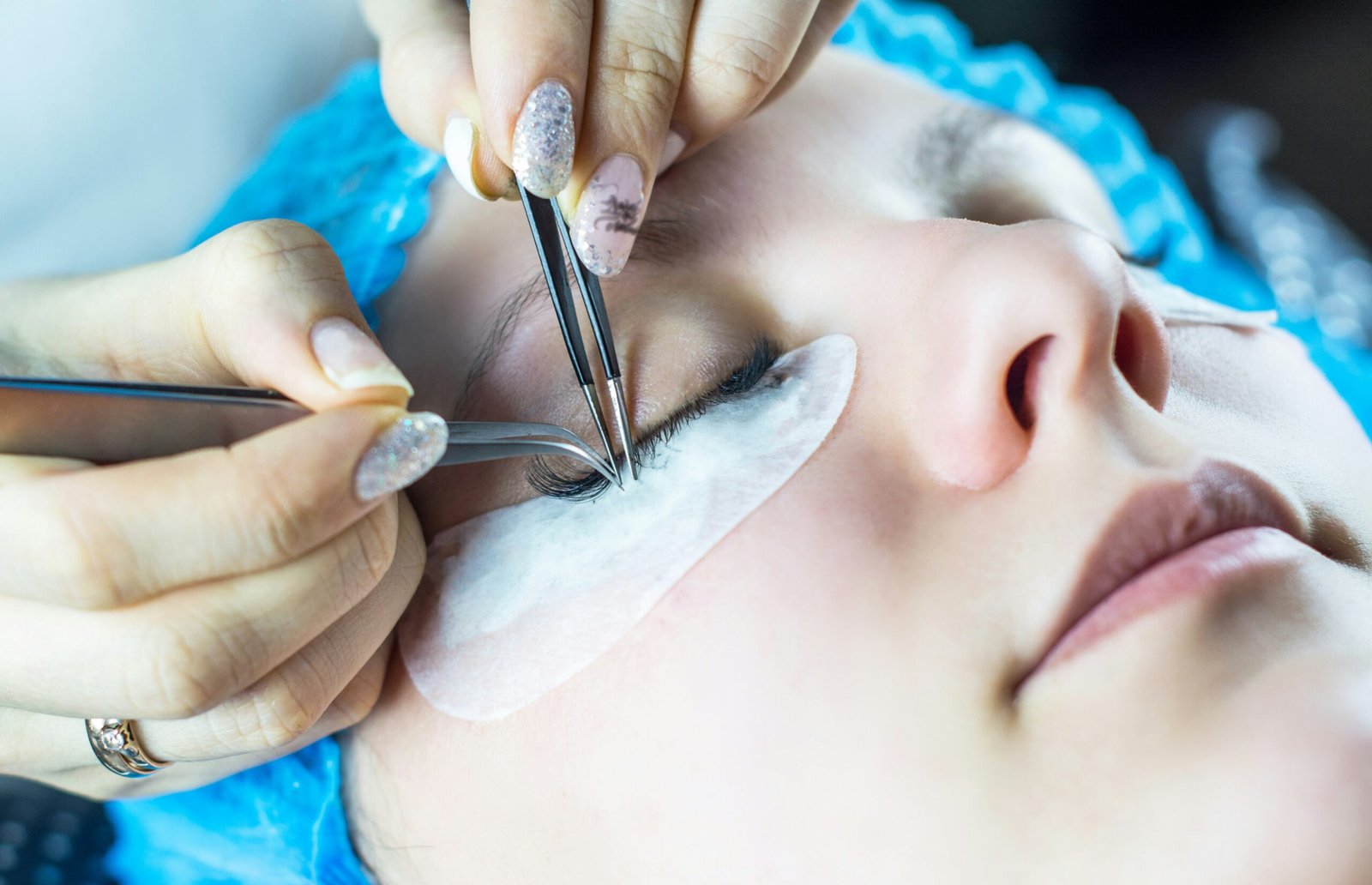 Eyelash Mites (Demodex) featuring causes, symptoms, treatment, eyelid hygiene, prevention, and eye health.